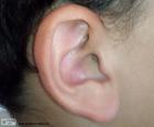 Human ear