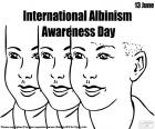 International Albinism Awareness Day, June 13. People with albinism are discriminated against in many parts of the world