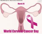March 26 World Cervical Cancer Day, a malignant tumor that affects the lower part of the uterus or womb, which with a timely study can prevent